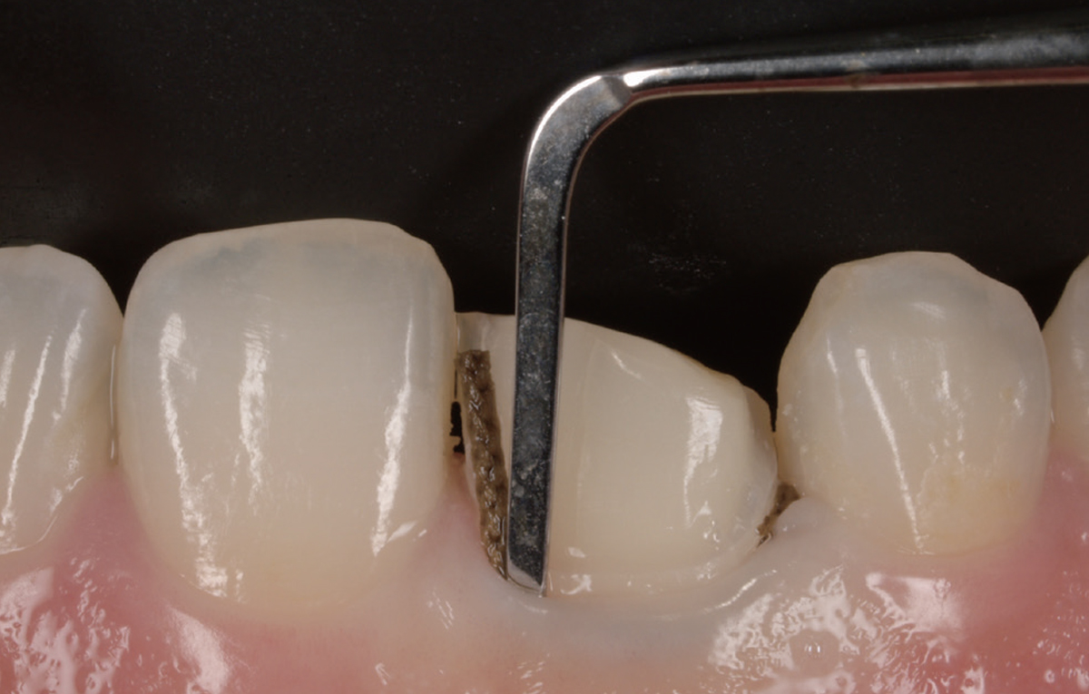 シュアーコード／シュアーコードプラス | 商品詳細 | 株式会社ヨシダ