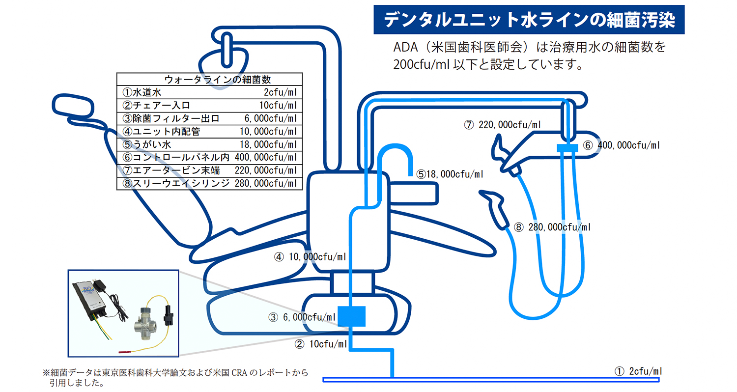 水ラインの細菌汚染