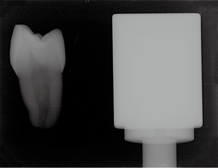 レジンブロック レジンブロック（ピンタイプ） | 山八歯材工業株式会社