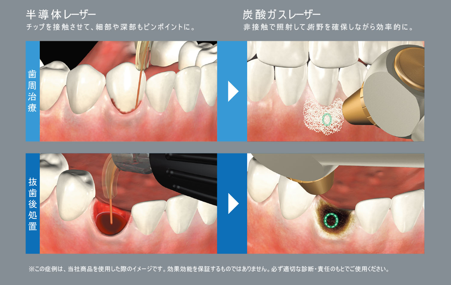 特性を“使い分ける” “合わせて使う”応用例