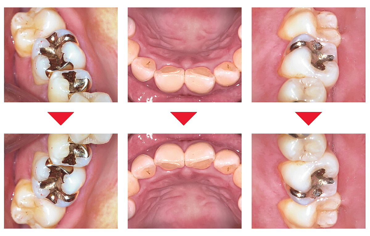 一瞬で切り替え可能な上下・左右反転機能 