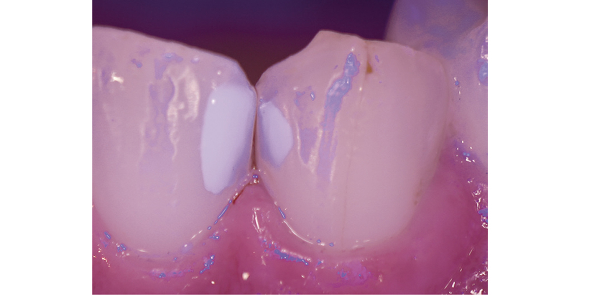 観察しやすくなるブルーライト機能