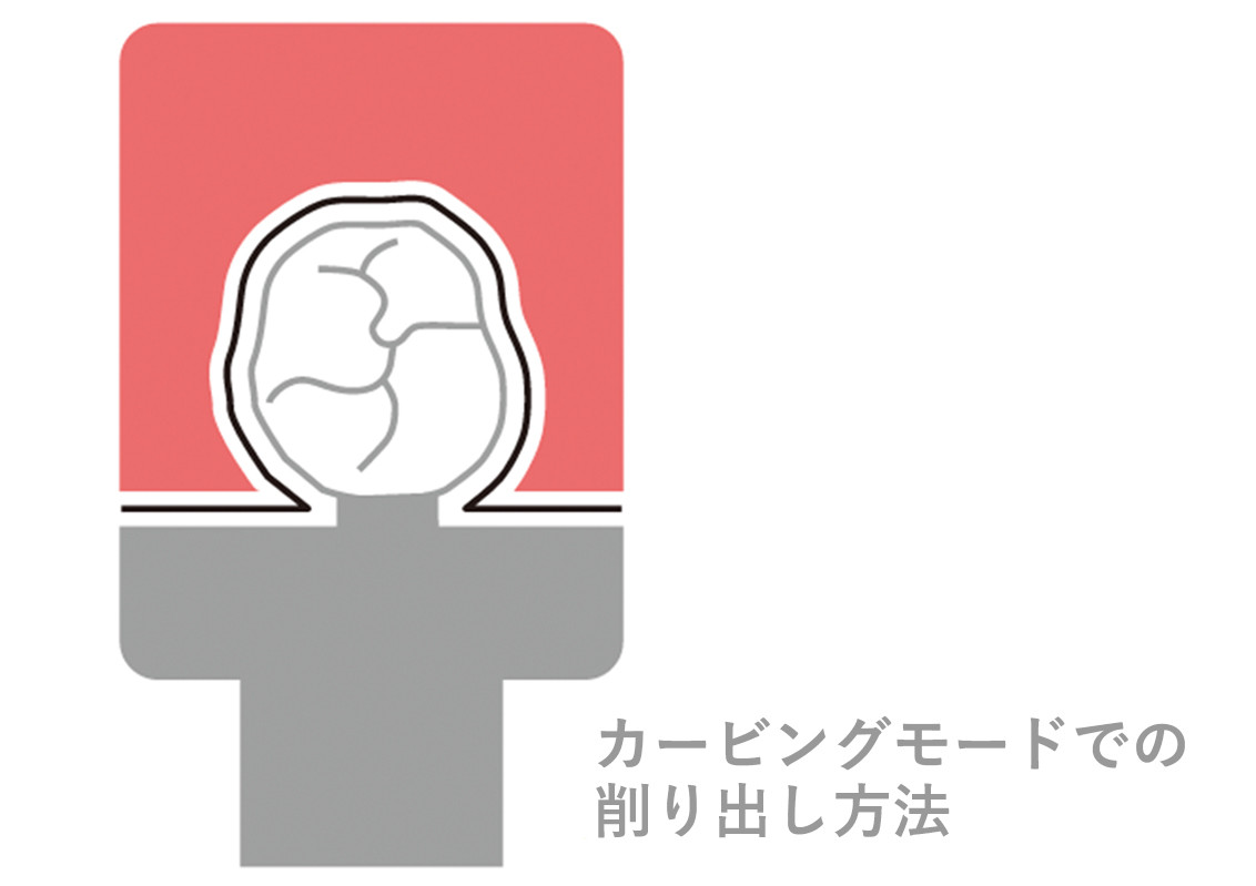 ワンデートリートメントも可能な加工スピード