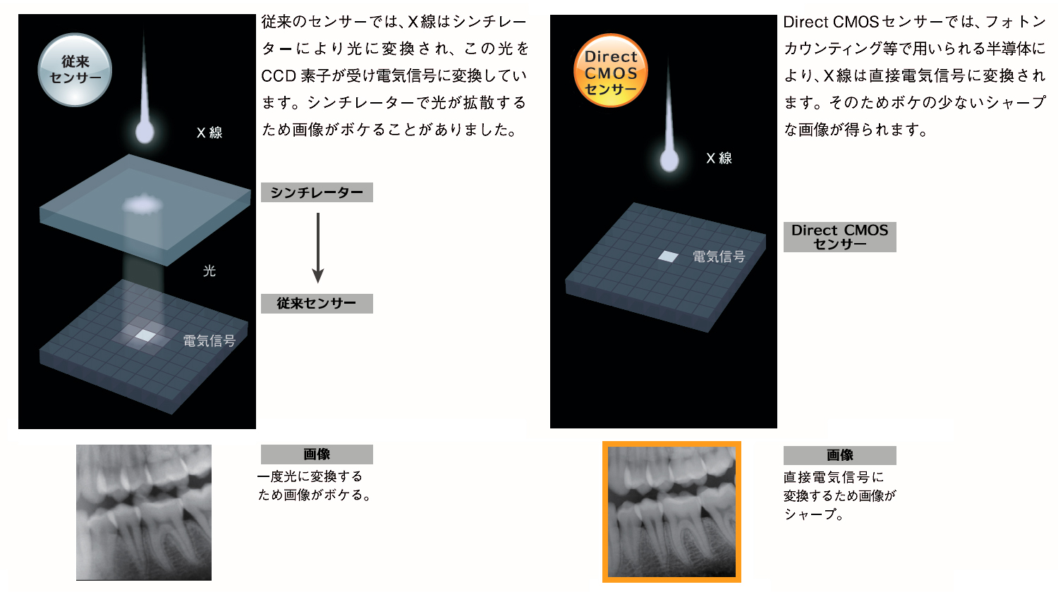 XeraSmart F+（エクセラスマート） | 商品詳細 | 株式会社ヨシダ