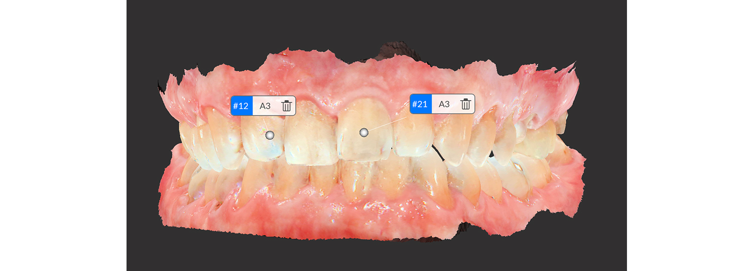 トロフィー 3DI ビヨンド | 商品詳細 | 株式会社ヨシダ