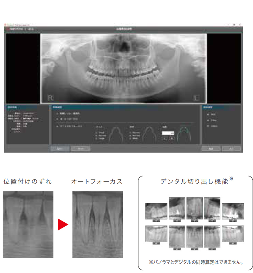 パノーラA1 | 商品詳細 | 株式会社ヨシダ