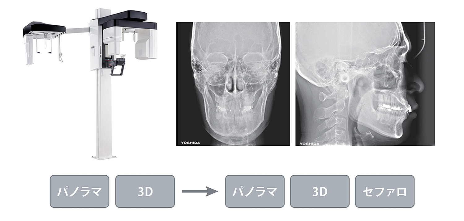 パノーラA1 | 商品詳細 | 株式会社ヨシダ