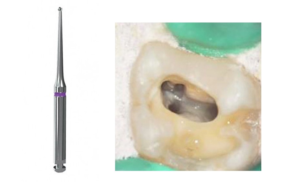 プレシジョン Endo Bur