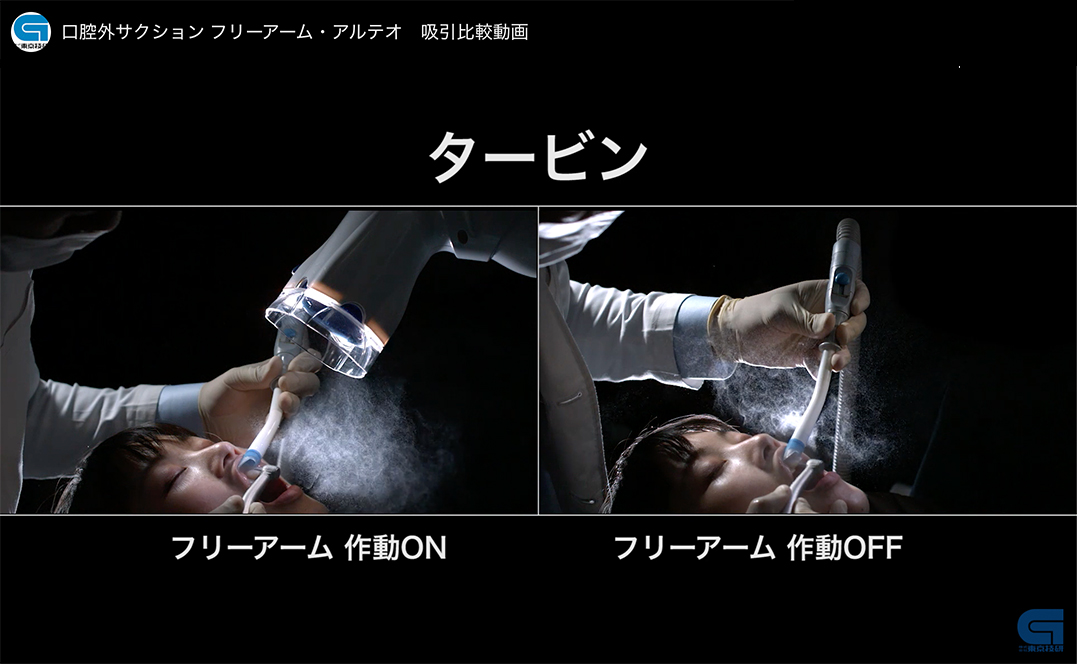 アルテオ比較動画