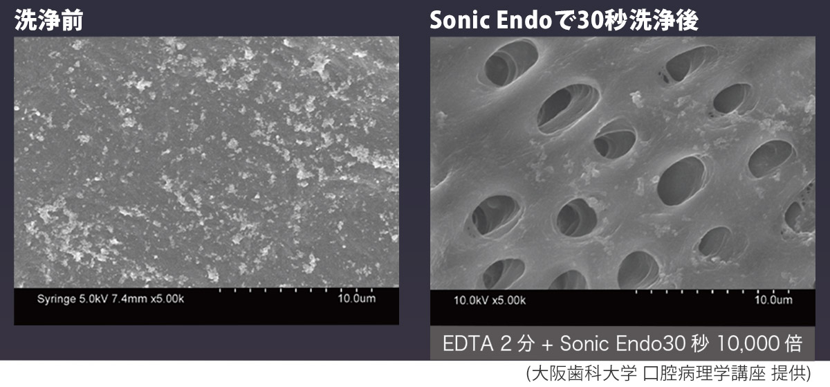 30秒間洗浄後のSEM画像