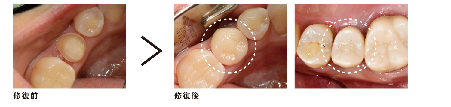 修復前後