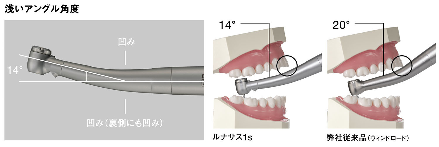 臼歯部へのアプローチも容易に