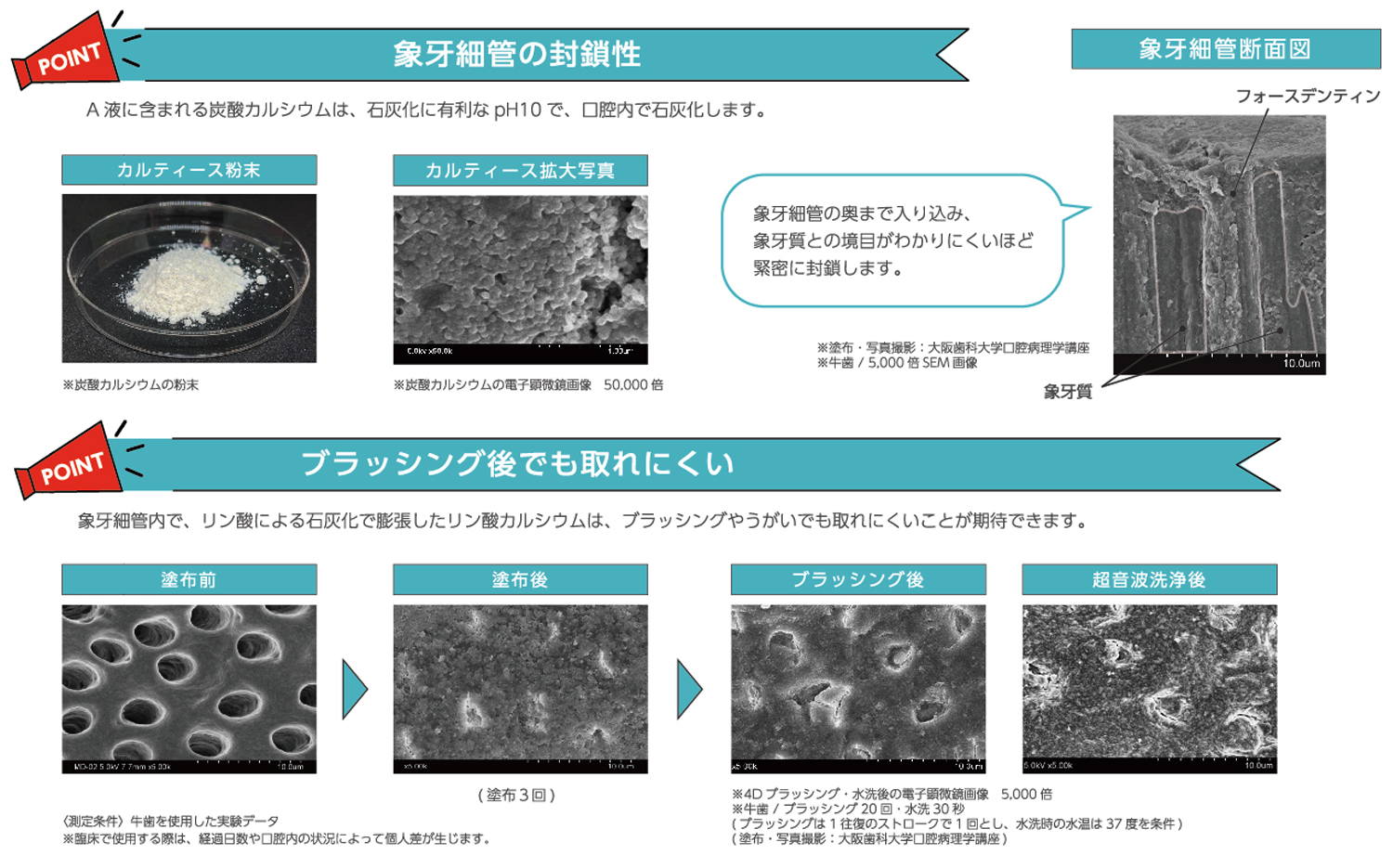 フォースデンティン | 商品詳細 | 株式会社ヨシダ