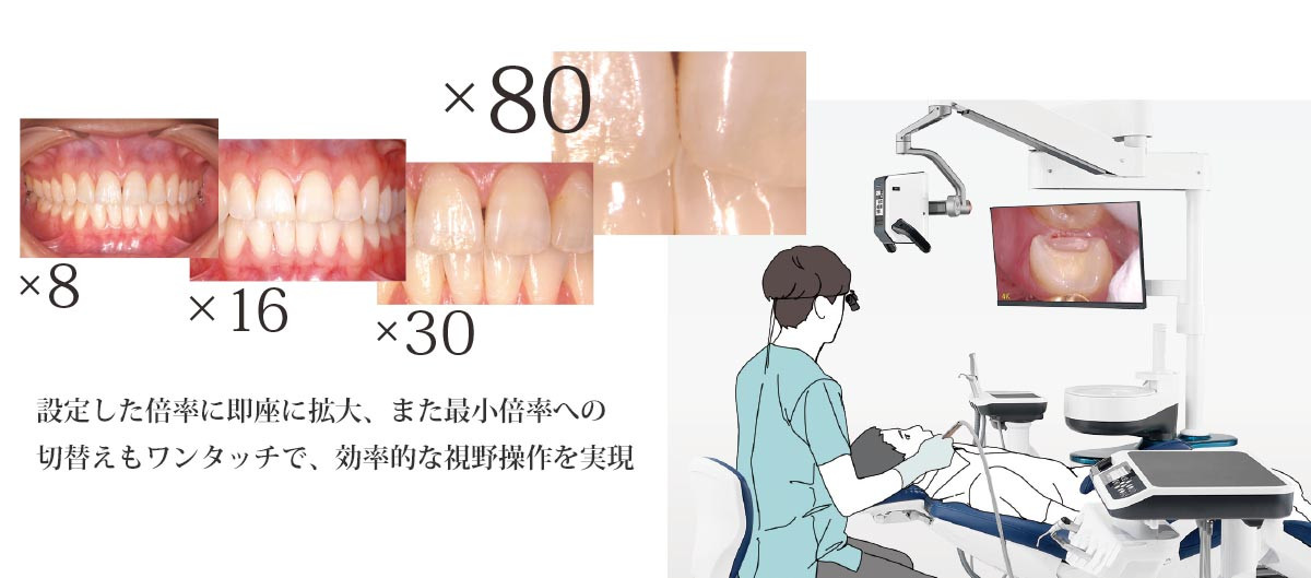 4K高画質・高精細・最高倍率80倍