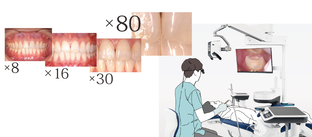 4K高画質・高精細・最高倍率80倍