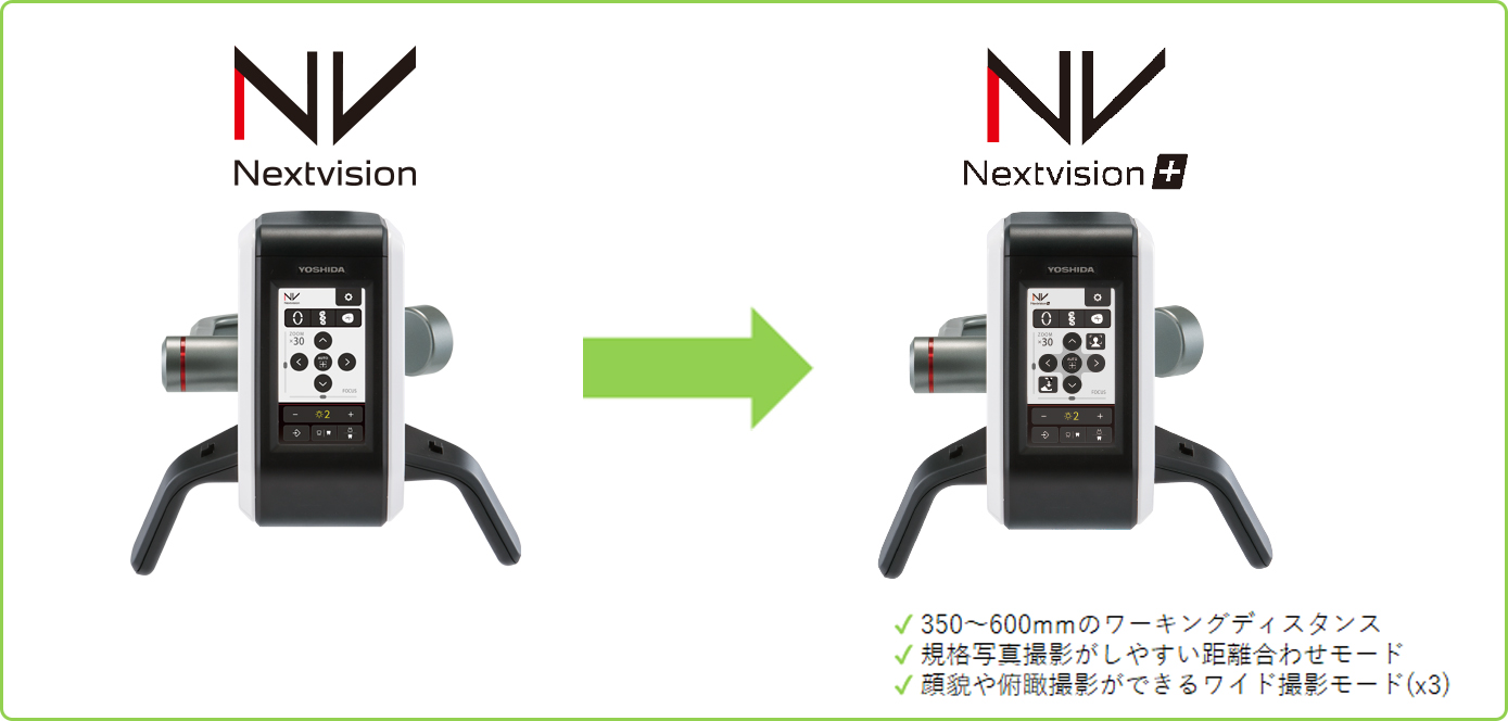 アップグレード