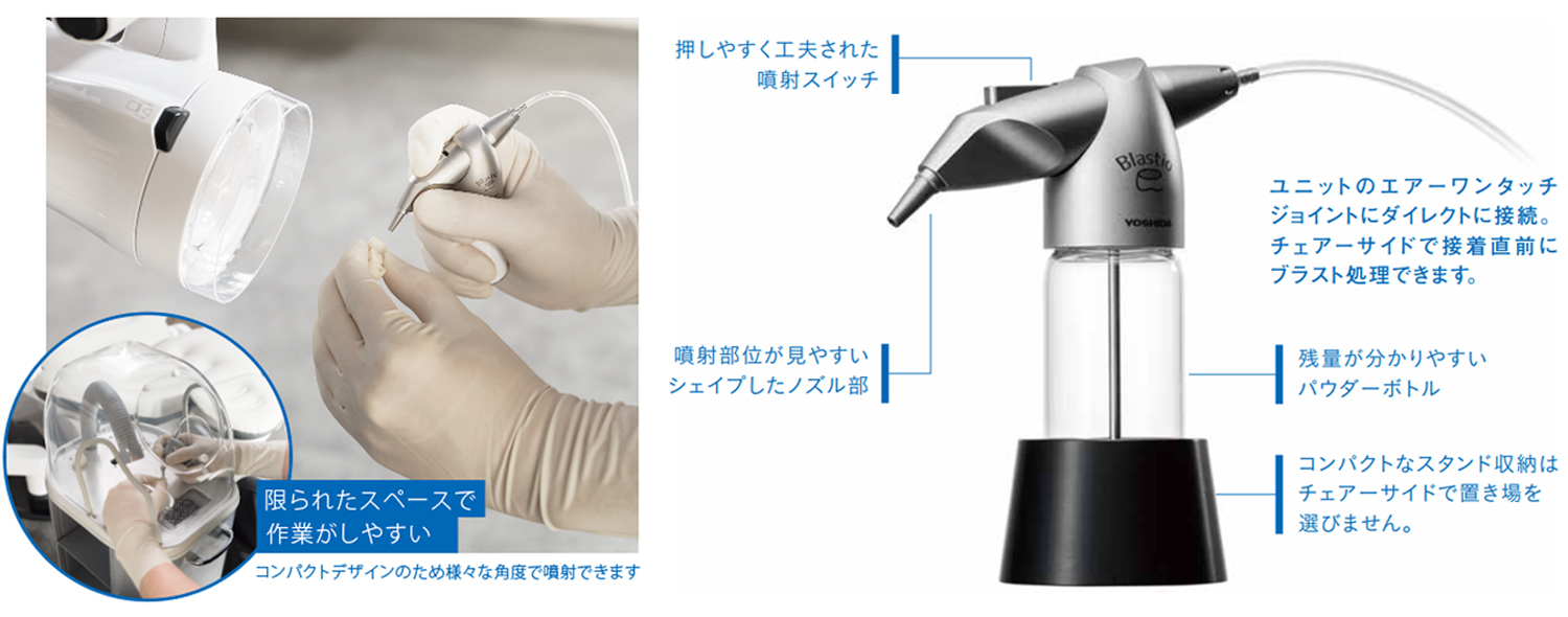 チェアサイドのブラスト処理を、もっと手軽に