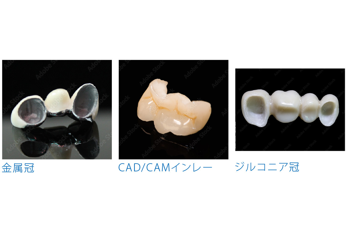 ブラスト処理する素材を選びません