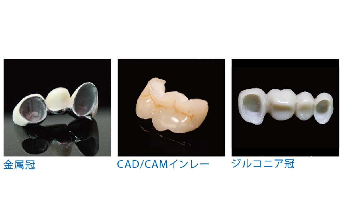 ブラスト処理する素材を選びません