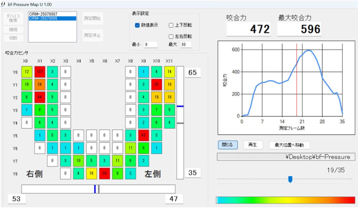 咬合圧検査時にリアルタイムで圧分布や前後左右のバランスの確認が可能